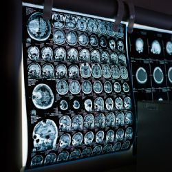Nový neurorehabilitační ústav na Pálavě