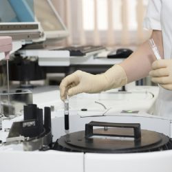 Masarykův onkologický ústav čeká dostavba a přinese nové ambulance, vyhlídku i možnosti parkování